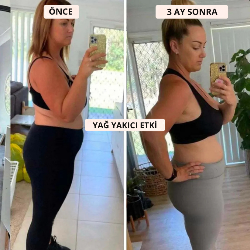 Legann™ 3D Toparlayıcı Tayt - Selülit, Ödem ve Lipödem Karşıtı