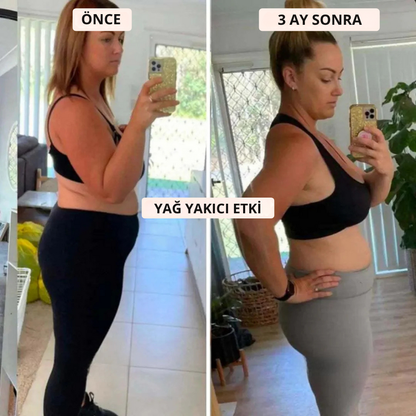 Legann™ 3D Toparlayıcı Tayt - Selülit, Ödem ve Lipödem Karşıtı