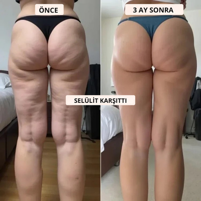 Legann™ 3D Toparlayıcı Tayt - Selülit, Ödem ve Lipödem Karşıtı